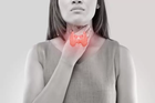 Best thyroid doctor singapore